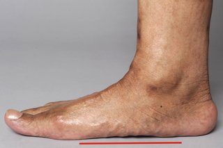 Flat Feet Pain Insoles